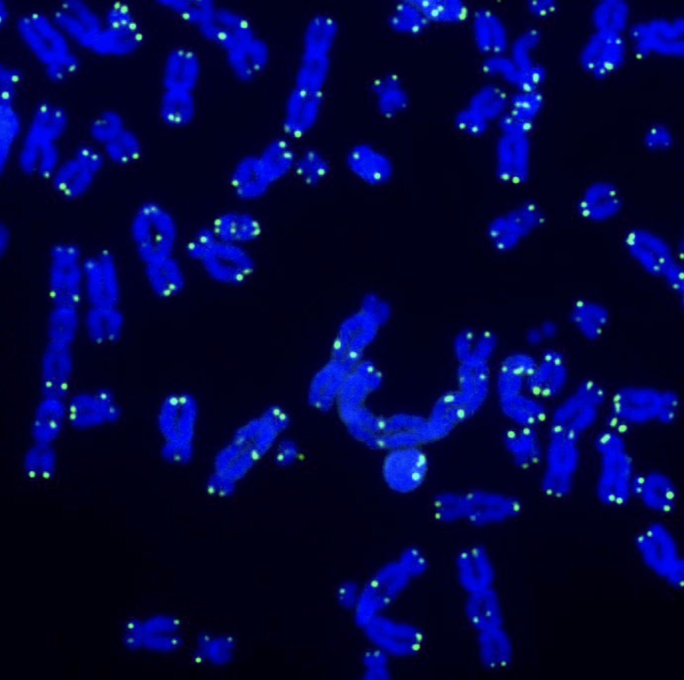 Electron microscopy of DNA repair, with DNA stained bright blue, telomeres in green in Ronnie Stangler MD good reads regarding Telomeres, Mitochondria, and Inflammation.